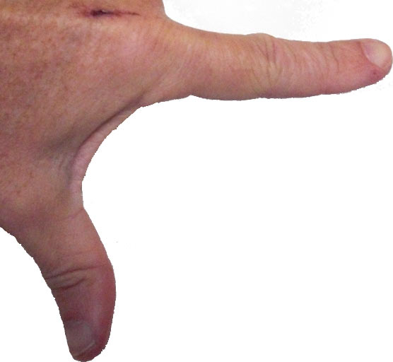 Al's left hand